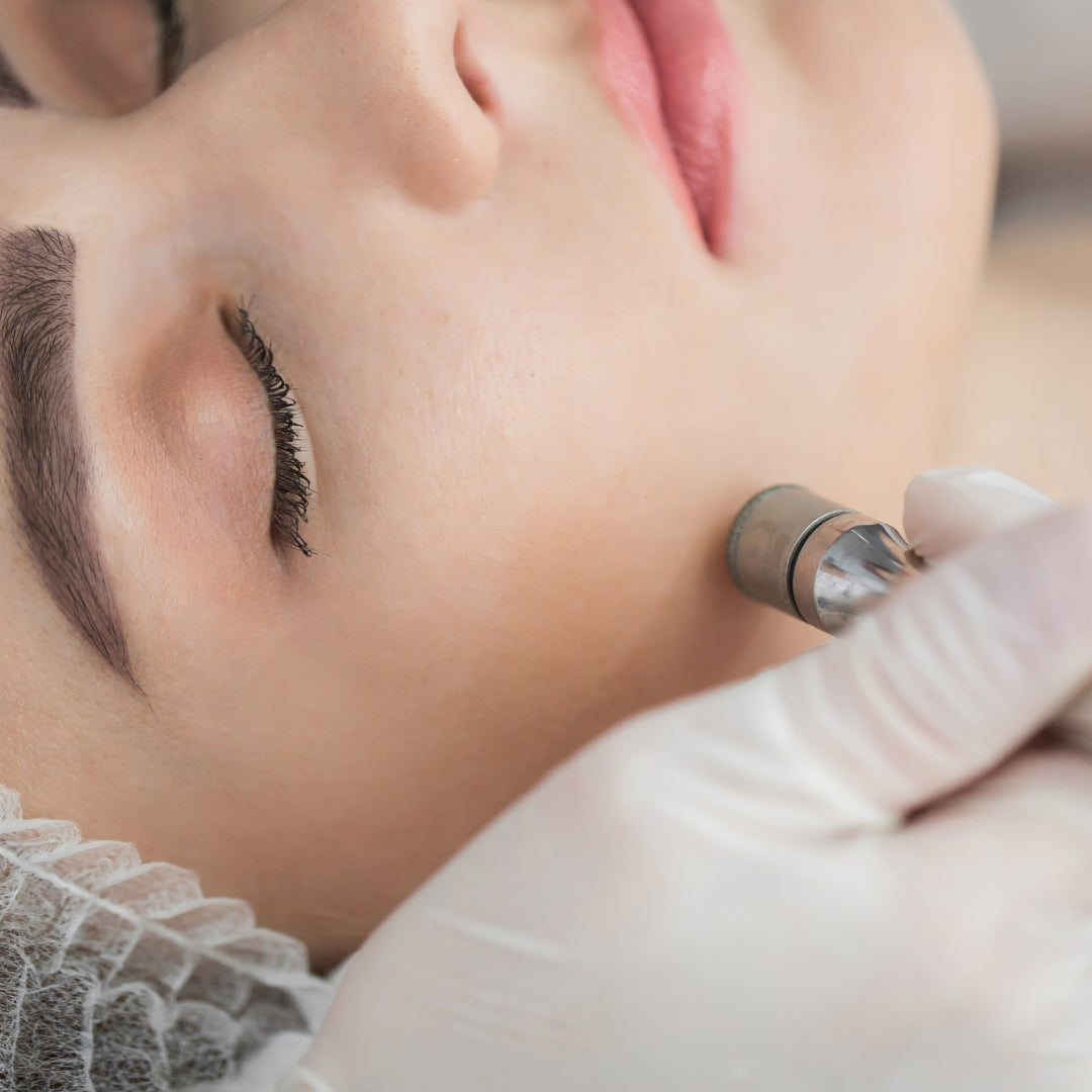 Express Microdermabrasion